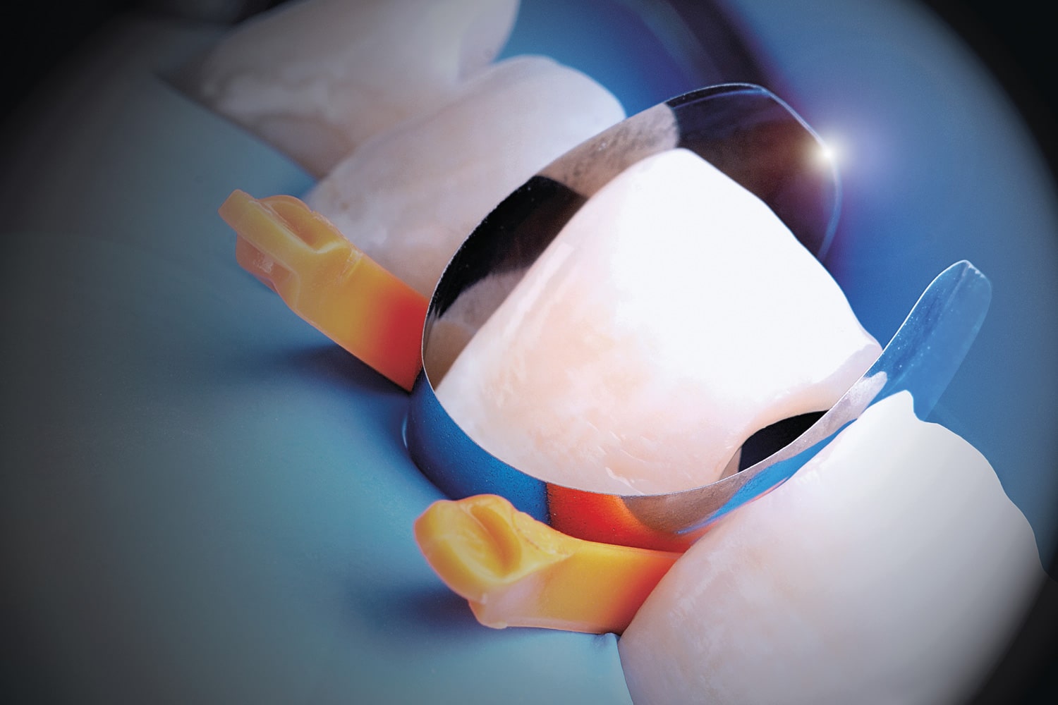 Unica_anterior_REF_6912_6950_Polydentia_Dr_Lazar