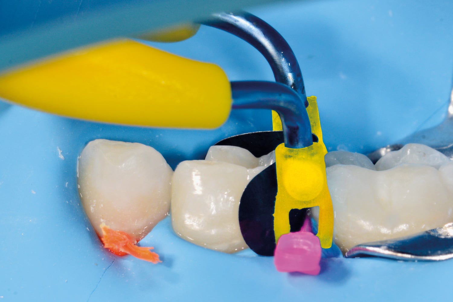 polydentia_mytinesjunior_6333_application